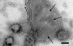 人工ウイルスワクチン（電子顕微鏡写真）